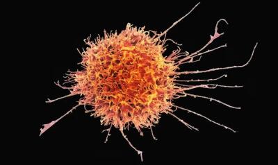 Meghalaya : East Khasi Hills-ah cancer vei an tam ber